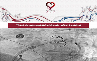 انجام نخستین درمان فیبریلاسیون دهلیزی در ایران در انستیتو قلب و عروق شهید رجایی با روش PFD